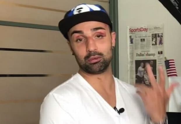 Paulie Malignaggi Releases Statement, Shares Photos Of Ridiculously Swollen Hands