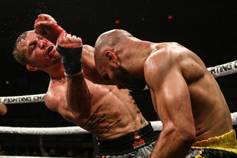 Graphic Photos: Artem Lobov & Jason Knight Show Off Damage Of Vicious War