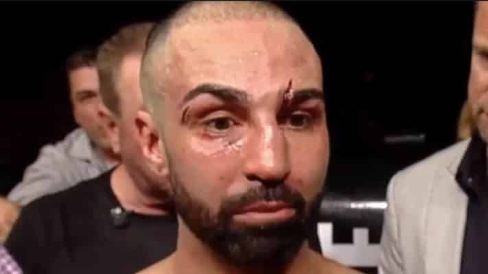 BKFC 6 Medical Suspensions: Paulie Malignaggi Out Indefinitely